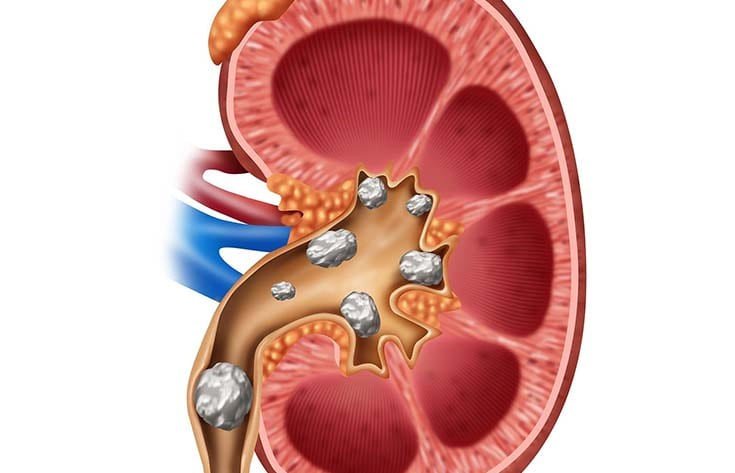 GRAD - Kidney Cure