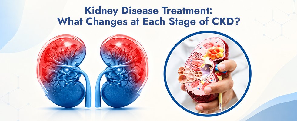Kidney Disease Treatment: What Changes at Each Stage of CKD?
